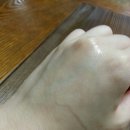 스킨로션