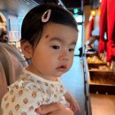 여의공감성형외과의원 | 돌아기 선천성 모반 제거 수술 후기 :: 오체안 성형외과의원 신사점을 선택한 이유, 비용/주차/진행과정