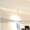 판암본치과의원 | 분당 치과의원 앞니 레진 비용? 병원 알아보기 전 반드시 읽어보세요