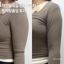 11620-15-73-7 | 처진팔뚝살 정리 2주차 기록, 팔지방흡입 후기 압박복 세탁