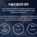 올바른솔루션