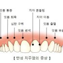 치아건강 챙기는 법// 서울아산병원 치과 김영성 교수님편 이미지