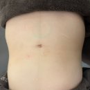 엠케이에너지 | 성신여대에스테틱 엠케이에스테틱에서 복부집중 파워슬리밍 관리로 라인까지 정리된 후기