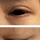 영신약국 | ⭐️내돈내산⭐️ 소세지눈 쌍수 재수술 + 눈매교정 😂 발품 후기! 홍보❌아님(+-눈밑지) 손품 메모 이미지 추가