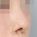 아베크 성형외과의원 이미지