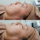 노브랜드토탈홈케어 | 위례피부관리) 래쉬더샤샤 스킨플래닝 - 프리미엄관리로 피부생기찾다. :D