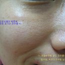 자글자글 이미지