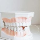 삼아치과기공소 | 보람동치과, &#39;이것&#39; 먼저 확인하고 가셔야합니다.