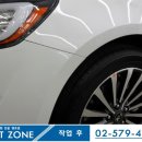 덴트존 이미지