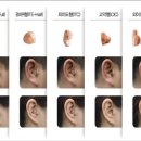 미래보청기 이미지