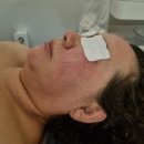 수앤나 | 시술후기 |턱선이 살아 났다!