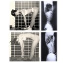 고려보조기 이미지