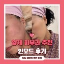 패션/양재 | 강남 양재역 피부과 인모드 솔직후기 (통증, 효과)