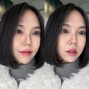 이수역 2번출구 뒤 | 이수역 피부과 티타늄 리프팅 솔직후기 심부볼 라인정리 시술 추천