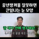 중년쌍꺼풀, 상안검 하면 안되는 눈이 있습니다!