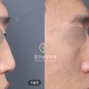 비주