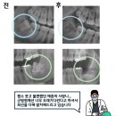 올바른홍치과의원 네이버블로그