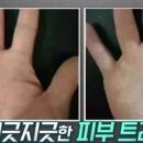 하루락꾸
