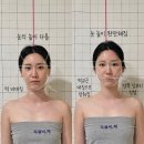화스킨바디 | 대신동 비체스킨앤바디랩 : 2회차 후기 이번엔 얼굴비대칭 관리 받았어요
