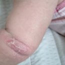 11500-22-25-08 | 공중비책 베이비 모이스처 로션, 6개월 아기 2주 사용 후기 및 추천(전후사진有)