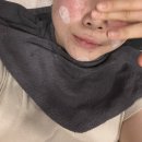 롯데쇼핑(주)롯데마트장유점 | 부산 화명동 피부과 추천 리쥬란힐러 2cc 손주사 후기