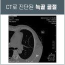 신우탕