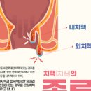 혈변 원인 5가지 및 과 대변 볼때 피 방법 치질 대장암 대장염 이미지