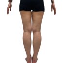 이오푸드 | 허벅지살빼는법, 계속 실패하다가 결국 이오팻주사 맞은 후기