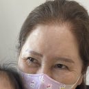 브리즈성형외과의원 | 내시경이마거상술 리프팅 눈밑지방재배치 내돈내산 후기 안산 브리즈성형외과