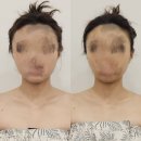 [마곡피부관리 + 발산피부관리 + 여름아이 뷰티끄] 데콜테와 윤곽관리로 다시 태어난 힐링 타임