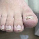 레푸스 감삼점&에이레네 이미지