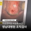 세븐일레븐 대구월성효성점 | 자궁경부암 비정형 소견으로 영대병원에서 조직검사 하다