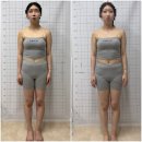 로온체형교정 | 부산체형교정 두골비 골반 다리 서면리프팅 로온 얼굴안면비대칭&자이로토닉 솔직후기