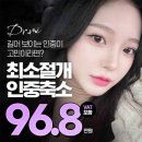 닥터미성형외과의원 | 인중축소수술 닥터미성형외과_인중축소 잘하는곳
