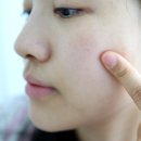(ECM) | 내돈내산 리디엔에이 스킨부스터 종류 ECM 리투오 효과 2주 후기