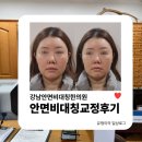 화목한의원 | 강남안면비대칭한의원 | 입꼬리 교정 및 턱 근육 피로 개선 위해 방문해봤어요!