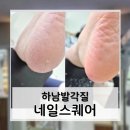감일백제로 | 하남발각질 감일네일 아기 발처럼 보들보들해진 네일스퀘어 후기