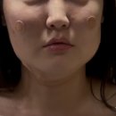 비너스의원 | 샘킴의원 비너스 달걀주사 1회 맞아본 솔직 후기