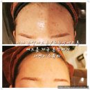 예쁜피부 이미지