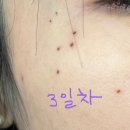 신세계가정의학과 네이버블로그