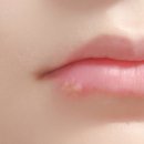 상봉그린한의원 | 어이 잔챙이들 내 친구가 할 말 있대