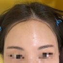 여의도 왁싱 | 라비왁싱 | 헤어라인이마왁싱 후기 | 디자인이 중요한 이유