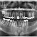 서울산성플란트치과의원 이미지