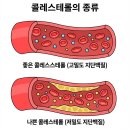 지질 검사[lipid test] 이미지