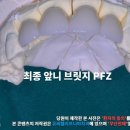 밝은이치과기공소 이미지