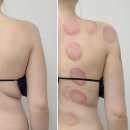 검단신도시 피부 윤곽관리 :: 아델라인 뷰티 바디테라피 관리후기