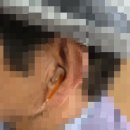 가본보청기 이미지