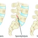 청년허리 이미지