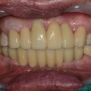 이천치과기공소 이미지