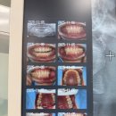 코리아치과의원 | [서울/강남] 오늘의치과 강남역 충치 치료 잘하는곳 내돈내산 솔직후기